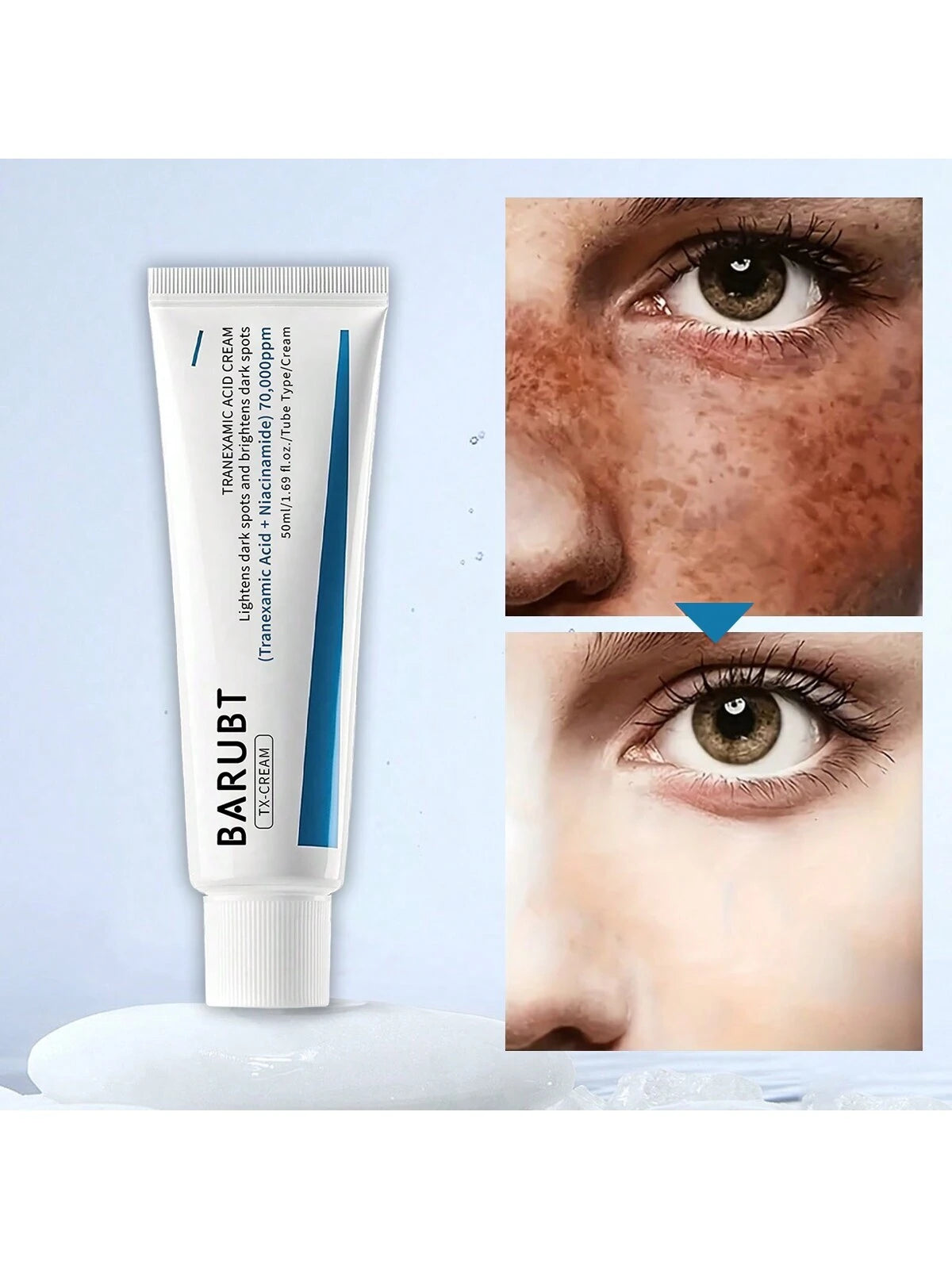 BARUBT Tranexamic Acid Cream 50ml — Dark Spot Care & Even Tone | كريم باروبت بحمض الترانيكساميك 50 مل — عناية بالبقع وتوحيد اللون