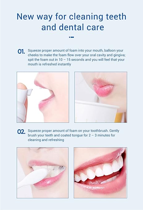 Teeth Whitening Mousse | موس تبييض الأسنان