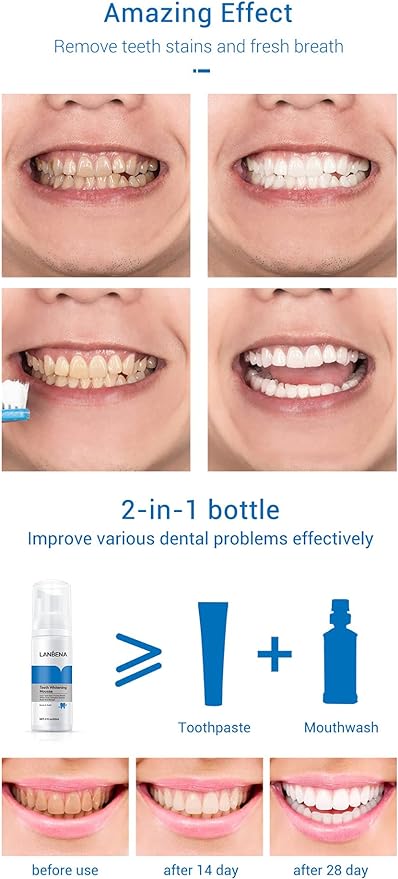 Teeth Whitening Mousse | موس تبييض الأسنان