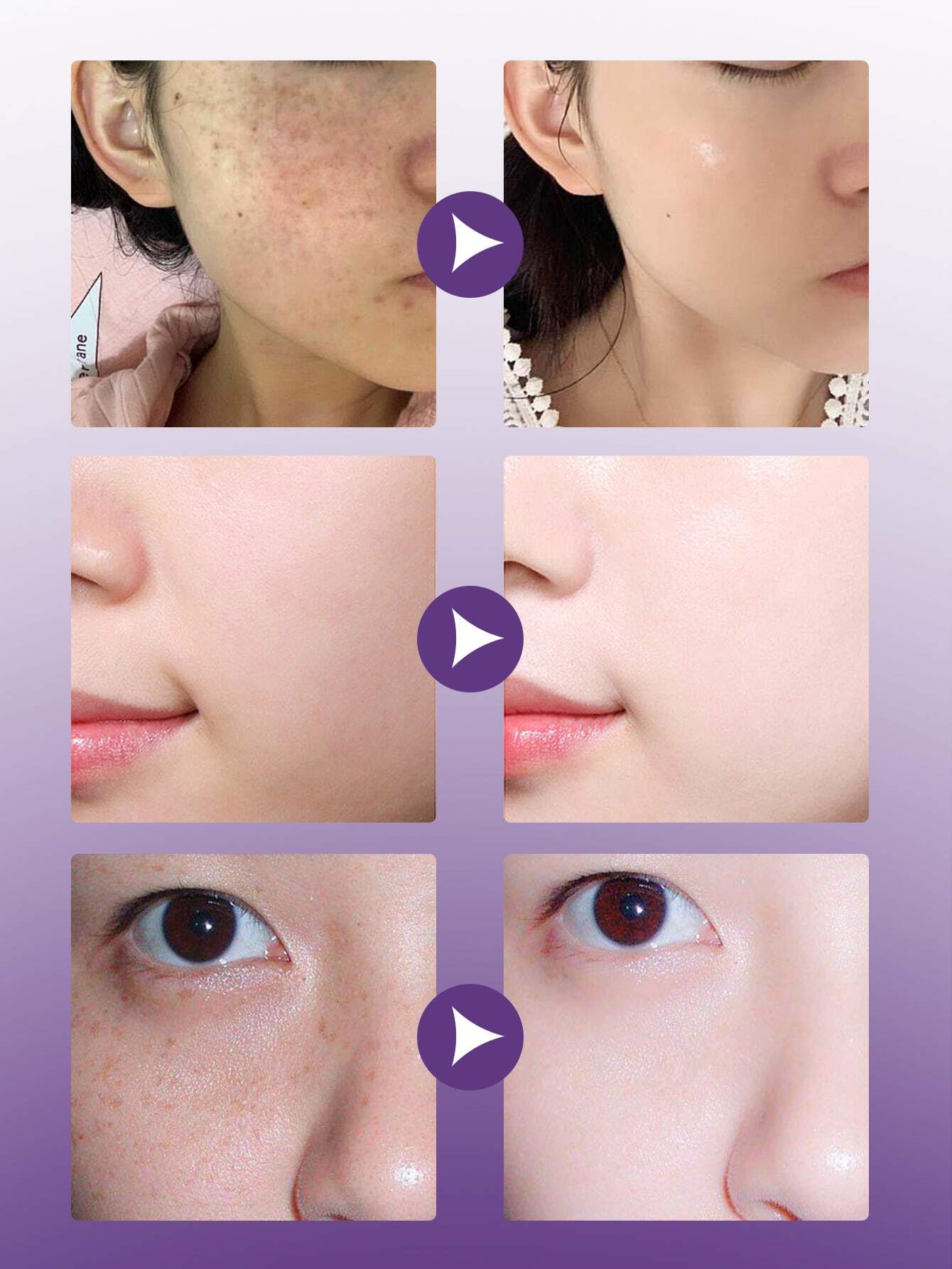 Niacinamide Ampoule Set – 7-Day Brightening & Hydration | مجموعة أمبولات نياسيناميد — تفتيح وترطيب لمدة 7 أيام