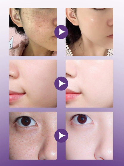 Niacinamide Ampoule Set – 7-Day Brightening & Hydration | مجموعة أمبولات نياسيناميد — تفتيح وترطيب لمدة 7 أيام